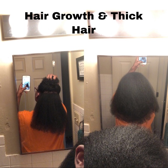 Stimulating Hair Growth Oil - Picture 5 of 5